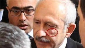 Kılıçdaroğlu'na saldırı