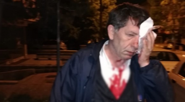 Gazeteci Yavuz Selim Demirağ'a saldırı...