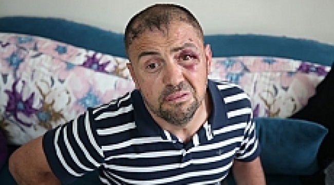 Dört kırığa sağlam raporu vermişler!