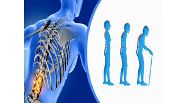 50 yaş üzeri 3 kadından ve 5 erkekten 1'inde kırığa neden oluyor