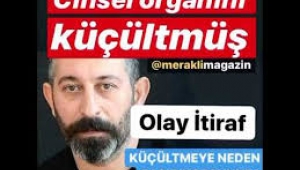 Ertuğrul Özkök: Cem Yılmaz 1999 yılında penis küçültme ameliyatı olmuş