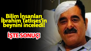 Bilim adamları İbrahim Tatlıses'in beynini inceledi Sonuç ne....