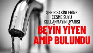 Musluk suyu kullanmayın, beyin yiyen mikrop var!