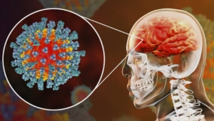 Covid-19 geçiren bazı beyinlerin 10 yıla kadar yaşlanabildiği, bazılarının da IQ seviyelerinin düştüğü anlaşılmış