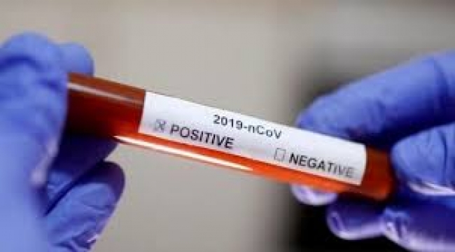 ABD'den flaş koronavirüs açıklaması 'Kökenini araştırmak faydasız'