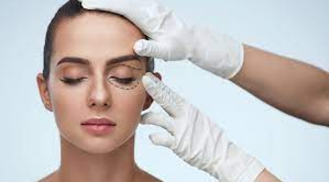 Göz Kapağı Ameliyatı