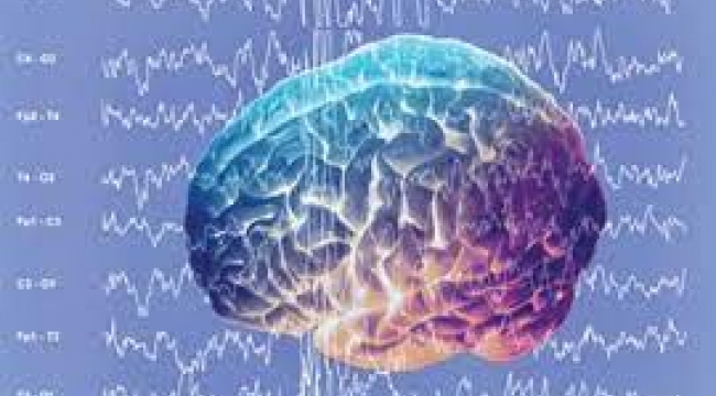Yeni bir beyin implantı ile düşünceler metne dönüşüyor
