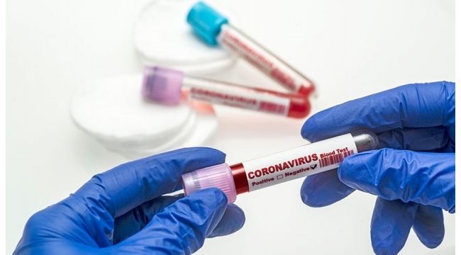 Türkiye'de Koronavirüs | 183 kişi daha hayatını kaybetti, 21 bin 692 yeni vaka tespit edildi