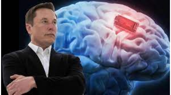 Elon Musk'ın hayali gerçek oluyor... İnsan beynine çip takacak!