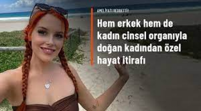 Hem Erkek Hem de Kadın Cinsel Organı ile Doğan Kadının Özel Hayatı
