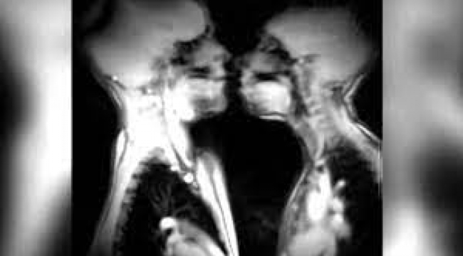 Hastanenin MR Cihazında Cinsel İlişkiye Giren Çiftin Görüntüleri Hayrete Düşürdü!
