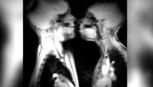 Hastanenin MR Cihazında Cinsel İlişkiye Giren Çiftin Görüntüleri Hayrete Düşürdü!