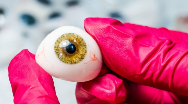 Protez Göz Ameliyatı Nasıl Yapılır?