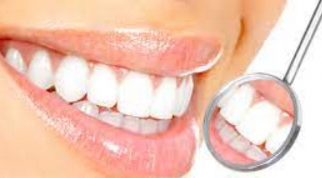 Profesyonel Diş Beyazlatma Uygulamaları: Sararan Dişlere Estetik Bir Veda