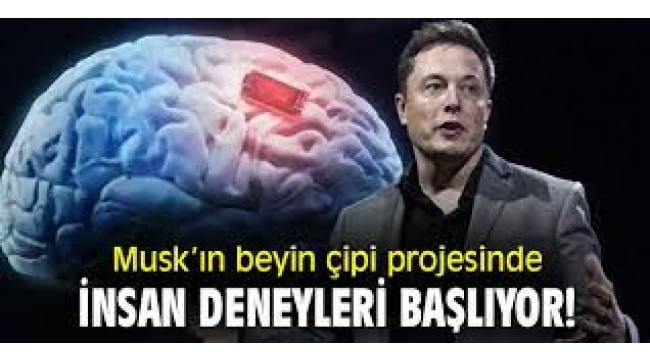 Beyin çipinde insan deneyleri başlıyor