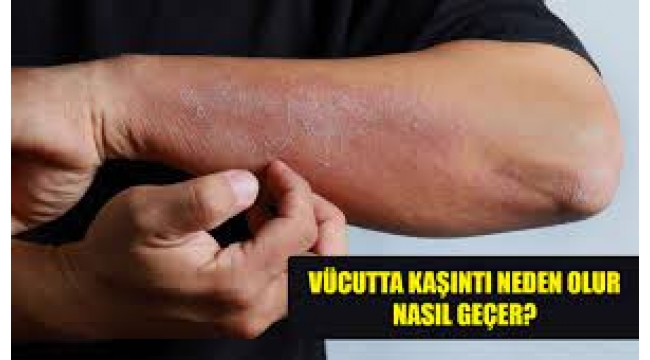 Kaşıntı nedenleri: Bulaşıcı bir hastalık belirtisi olabilir!