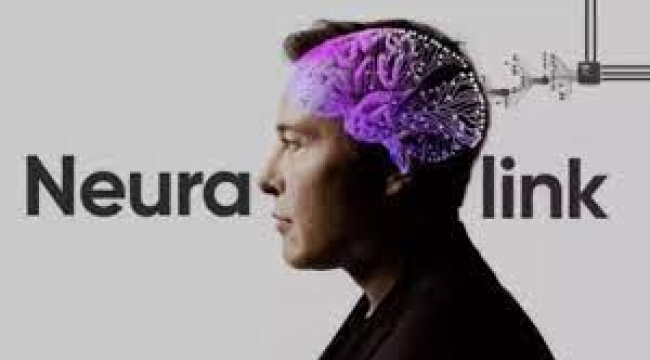 Neuralink beyin implantı için insan denemesine başlıyor