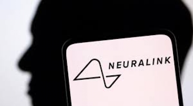 Neuralink beyin implantı için insan denemesine başlıyor