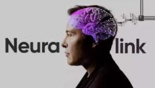 Neuralink beyin implantı için insan denemesine başlıyor