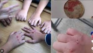 Tiktok'tan yayıldı: Okullardaki tehlikeli oyun "Kanlı Para"
