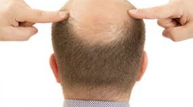 2023'ün En Seksi Kel Erkeği Belli Oldu!