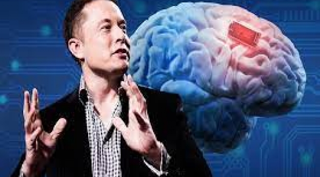 Elon Musk'i beyin çipi takmaya hazır