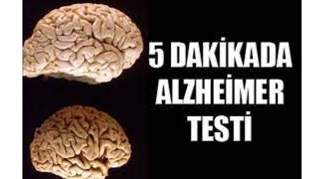 İşte En Basit Alzheimer Testi!