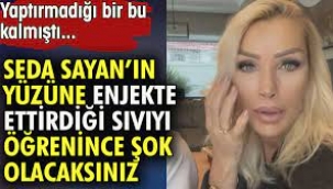 Seda Sayan yüzüne sünnet derisi enjekte ettirdi