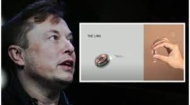 Elon Musk "bir ilk" diyerek duyurdu! İnsan beynine çip yerleştirildi.