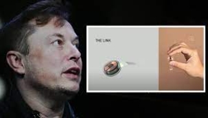 Elon Musk "bir ilk" diyerek duyurdu! İnsan beynine çip yerleştirildi.