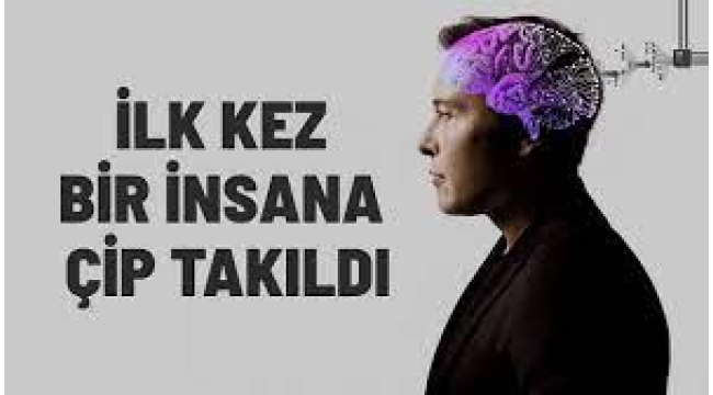 Beynine çip takılan ilk insan bir ilki gerçekleştirdi