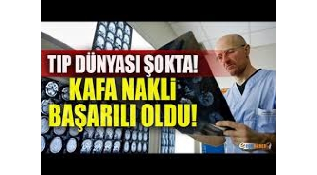 Prof. Dr. Ömer Özkan'dan kafa ve beyin nakli yorumu