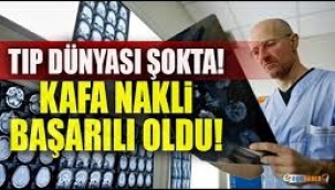 Prof. Dr. Ömer Özkan'dan kafa ve beyin nakli yorumu