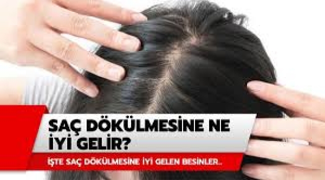Saç Dökülme Karşıtı Ne İyi Gelir?