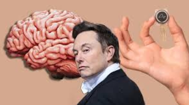 Musk: 'Beyin Çipi İkinci Hastaya da Takıldı'
