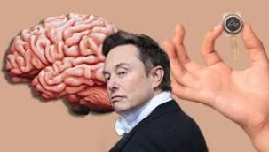 Musk: 'Beyin Çipi İkinci Hastaya da Takıldı'