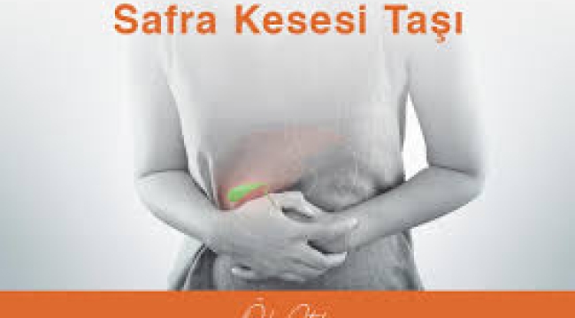 Safra kesesi taşları: Mide ağrısı diyerek geçiştirmeyin!