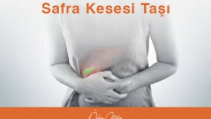 Safra kesesi taşları: Mide ağrısı diyerek geçiştirmeyin!