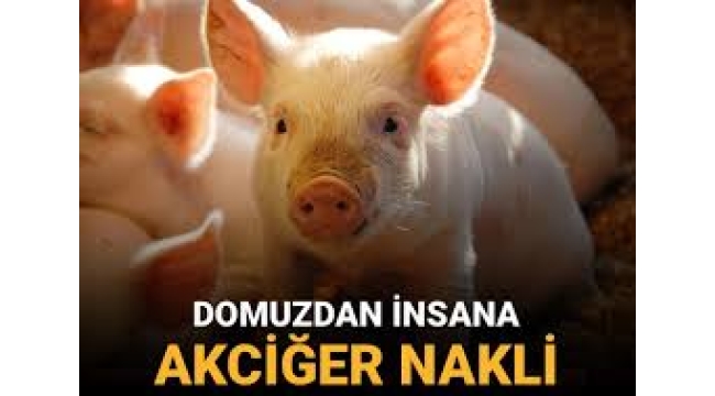 Tıp tarihinde bir ilk: Domuz akciğeri insana nakledildi