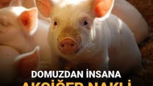Tıp tarihinde bir ilk: Domuz akciğeri insana nakledildi