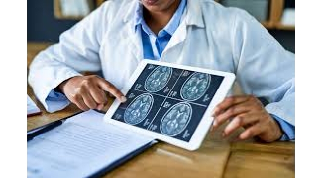 Alzheimer vakaları neden arttı?