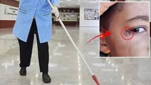 Temizlik görevlisi ilkokul öğrencisinin gözünde sigara söndürdü