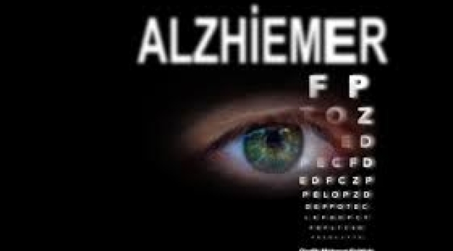 Alzheimer sonunda tarih mi oluyor?.