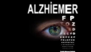 Alzheimer sonunda tarih mi oluyor?.