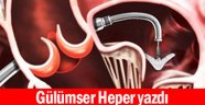 Açık kalp ameliyatları sahiden bitiyor mu