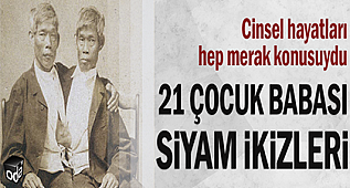 21 Çocuk babası Siyam İkizleri