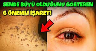 Sana Büyü Yapıldığını Gösteren 6 Önemli İşaret! Aman Dikkat